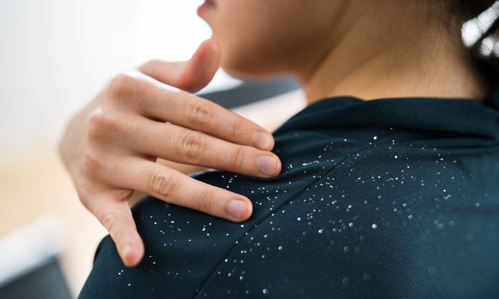 How to Get Rid of Severe Dandruff? DrHouse